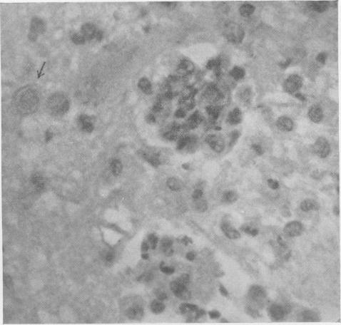 https://cdn.ncbi.nlm.nih.gov/pmc/blobs/7a0c/2041753/d9ca562f2eae/jmedres00002-0073-b.jpg