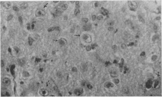 https://cdn.ncbi.nlm.nih.gov/pmc/blobs/7a0c/2041753/fb8463e661e0/jmedres00002-0072-c.jpg