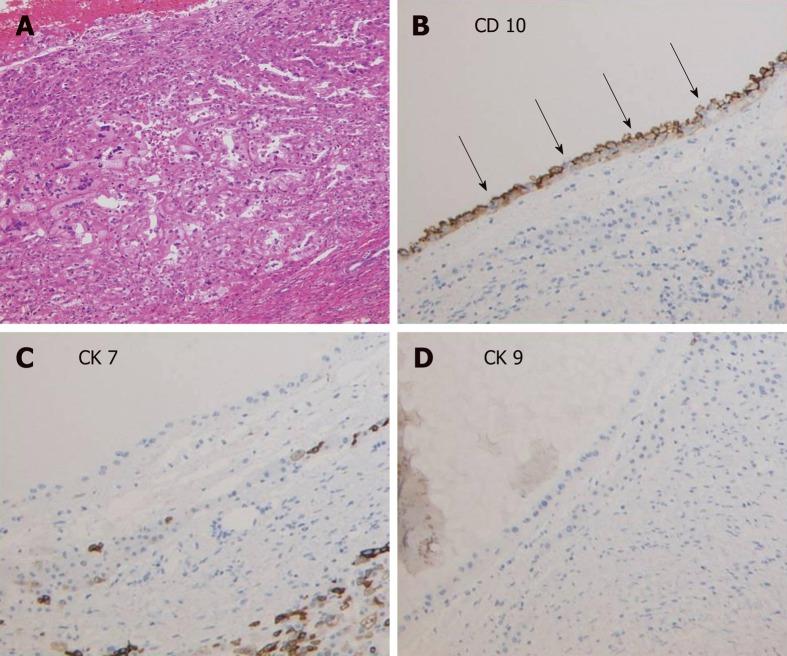 https://cdn.ncbi.nlm.nih.gov/pmc/blobs/7a14/6526153/a0816495aa3b/WJG-25-2264-g003.jpg