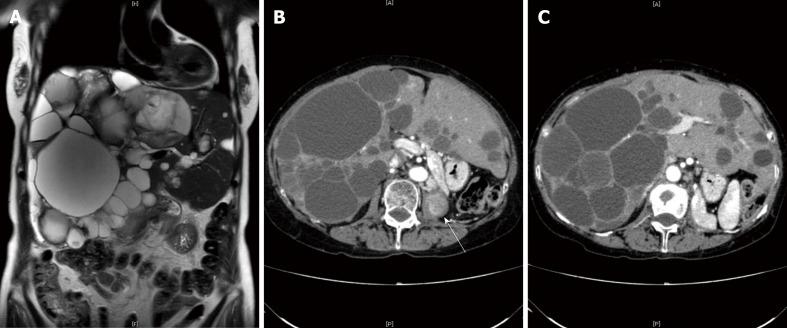 https://cdn.ncbi.nlm.nih.gov/pmc/blobs/7a14/6526153/c9c3b48c5677/WJG-25-2264-g002.jpg