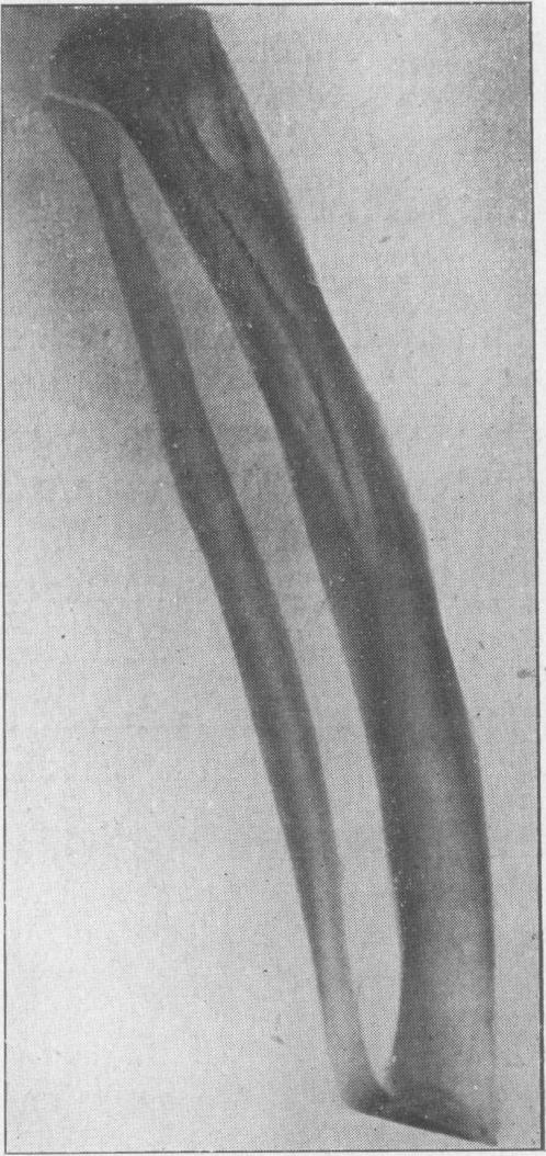 https://cdn.ncbi.nlm.nih.gov/pmc/blobs/7a18/2182201/5e4755888623/procrsmed00539-0016-b.jpg