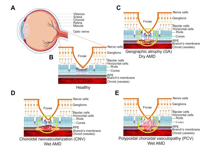 https://cdn.ncbi.nlm.nih.gov/pmc/blobs/7a1e/8720701/a1ce529ba1e2/gr1.jpg