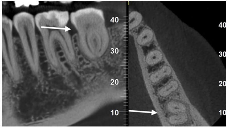 https://cdn.ncbi.nlm.nih.gov/pmc/blobs/7a20/11120491/bd816f14cc93/dentistry-12-00124-g004.jpg