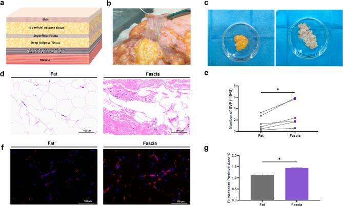 https://cdn.ncbi.nlm.nih.gov/pmc/blobs/7a21/11863534/4764e56540f9/13287_2025_4204_Fig1_HTML.jpg
