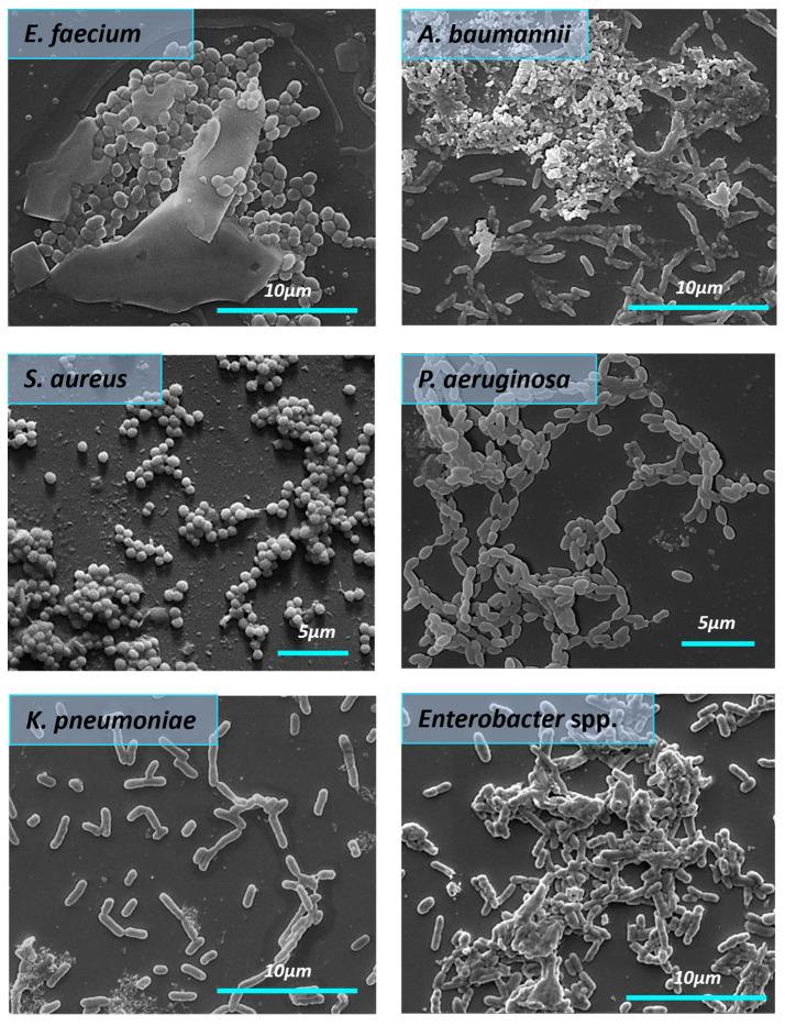 https://cdn.ncbi.nlm.nih.gov/pmc/blobs/7a27/10818322/b1dc1b850fcc/nanomaterials-14-00137-g007.jpg