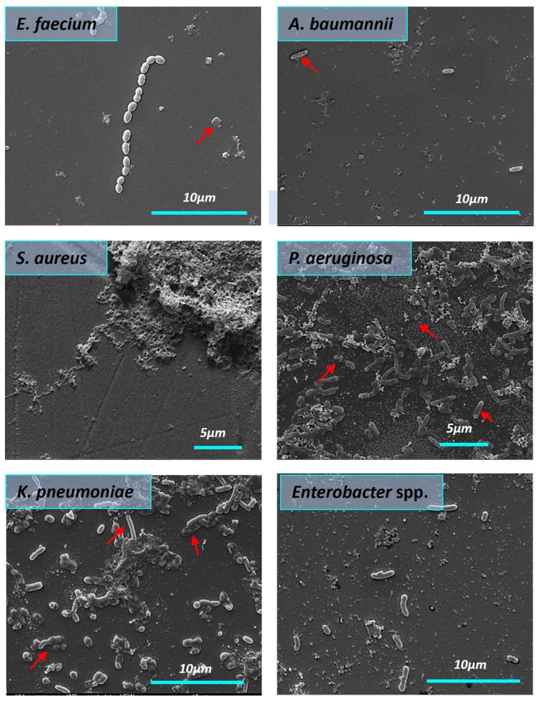https://cdn.ncbi.nlm.nih.gov/pmc/blobs/7a27/10818322/be55299ba610/nanomaterials-14-00137-g009.jpg
