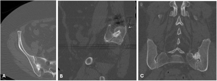 https://cdn.ncbi.nlm.nih.gov/pmc/blobs/7a42/12360366/786b52cf140e/ORR-17-381-g0005.jpg