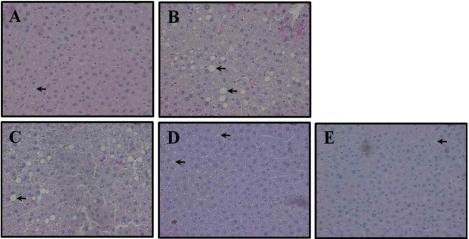 https://cdn.ncbi.nlm.nih.gov/pmc/blobs/7a44/3315195/fb7d58d2070f/lar-28-23-g005.jpg