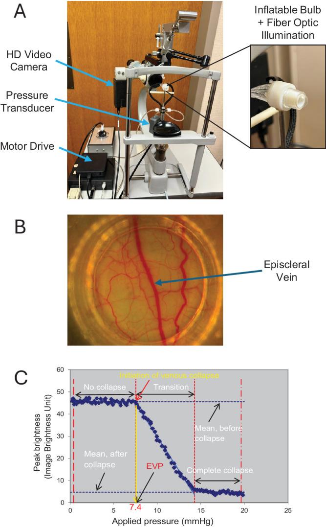 https://cdn.ncbi.nlm.nih.gov/pmc/blobs/7a46/12369919/ef81f34f3f90/iovs-66-11-44-f001.jpg
