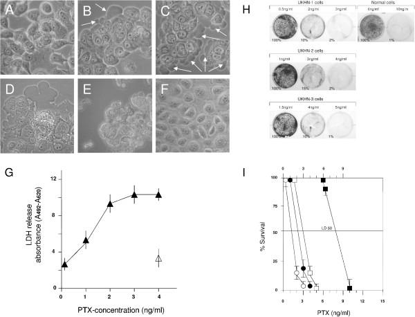 https://cdn.ncbi.nlm.nih.gov/pmc/blobs/7a4a/3585753/a50b33ebc665/1476-4598-12-12-1.jpg
