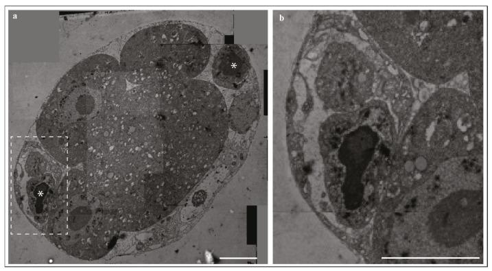 https://cdn.ncbi.nlm.nih.gov/pmc/blobs/7a53/8618802/bc147f9350f6/ijms-22-12466-g001.jpg