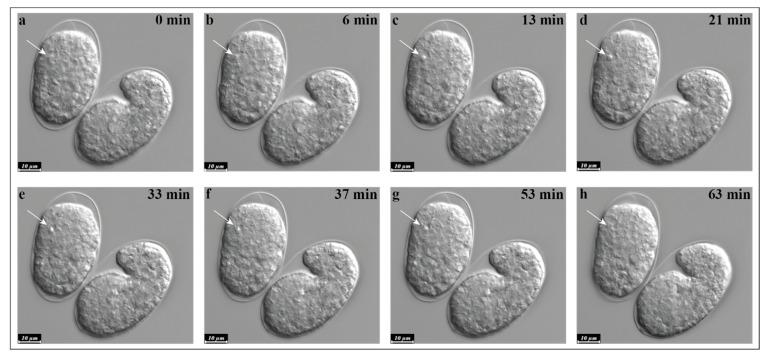 https://cdn.ncbi.nlm.nih.gov/pmc/blobs/7a53/8618802/c461d54d17af/ijms-22-12466-g002.jpg