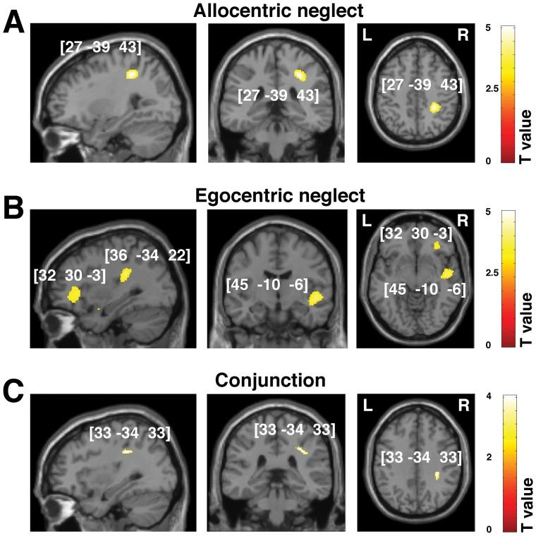 https://cdn.ncbi.nlm.nih.gov/pmc/blobs/7a5c/3486857/1a28570522b8/pone.0047821.g005.jpg
