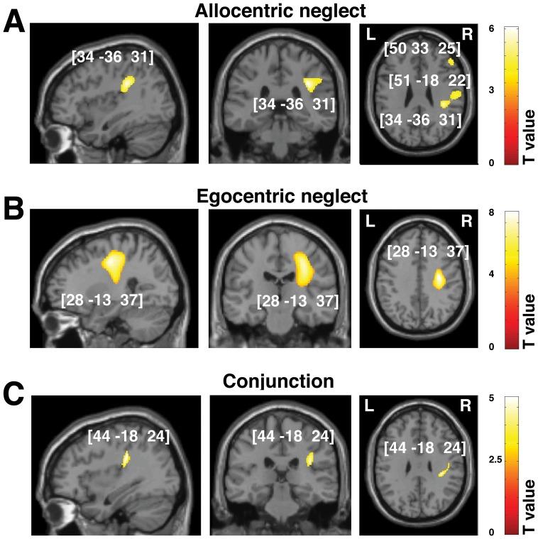 https://cdn.ncbi.nlm.nih.gov/pmc/blobs/7a5c/3486857/b79184b1a09b/pone.0047821.g004.jpg