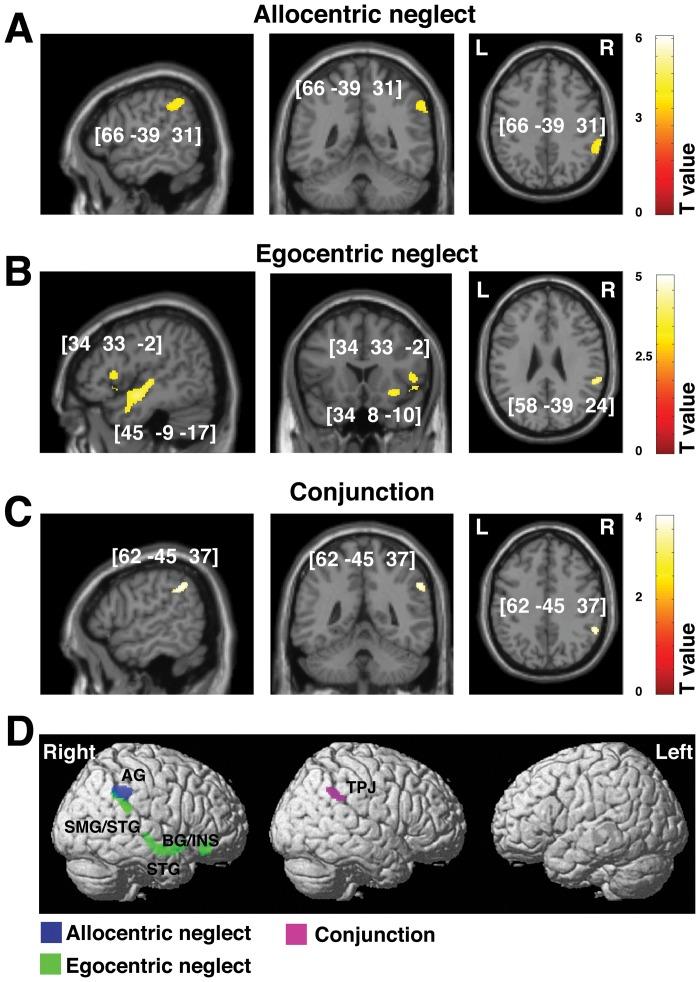 https://cdn.ncbi.nlm.nih.gov/pmc/blobs/7a5c/3486857/c49a560fd6b8/pone.0047821.g003.jpg