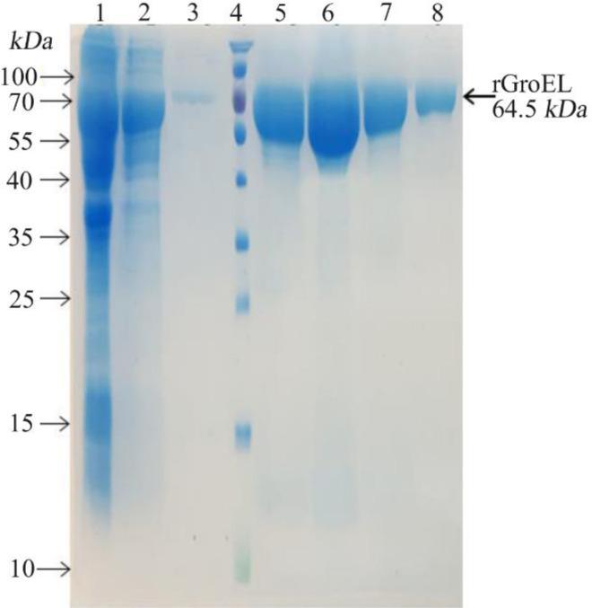 https://cdn.ncbi.nlm.nih.gov/pmc/blobs/7a60/9706248/1328c0b72474/AJMB-14-294-g002.jpg