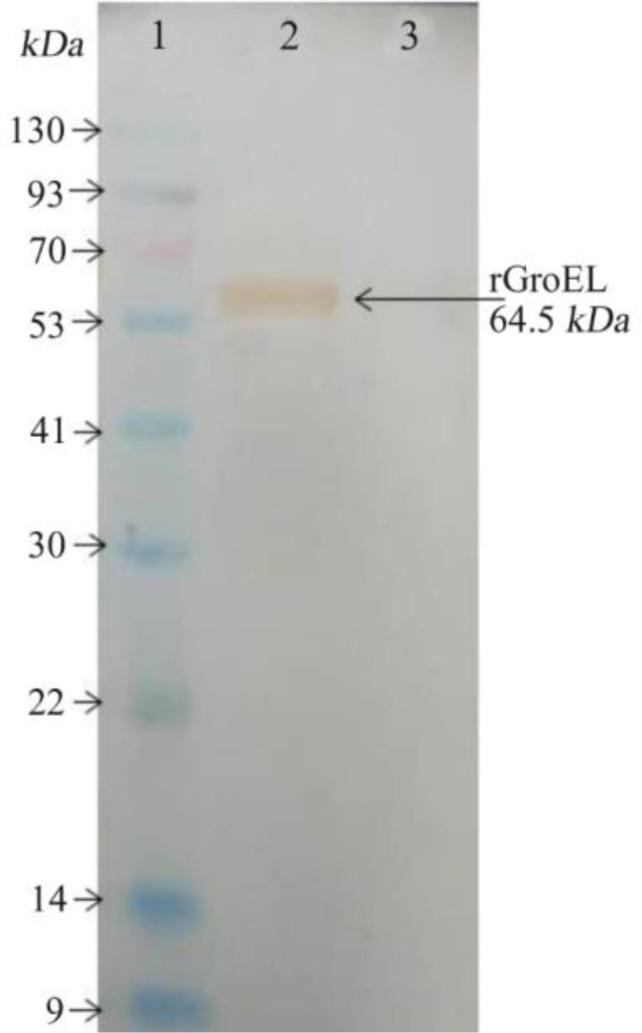 https://cdn.ncbi.nlm.nih.gov/pmc/blobs/7a60/9706248/371d8d917fff/AJMB-14-294-g003.jpg