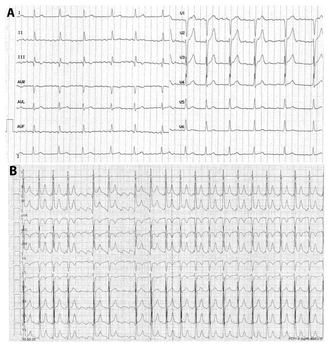 https://cdn.ncbi.nlm.nih.gov/pmc/blobs/7a65/11642268/ce5d7c80675f/jcm-13-07259-g004.jpg