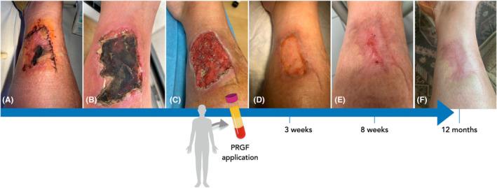 https://cdn.ncbi.nlm.nih.gov/pmc/blobs/7a65/11808476/11a45f91876e/PRD-97-320-g002.jpg