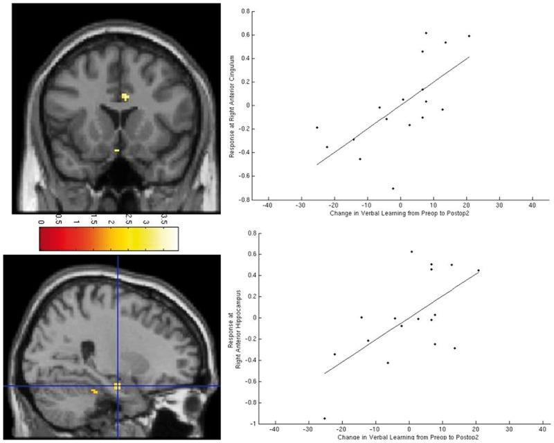 https://cdn.ncbi.nlm.nih.gov/pmc/blobs/7a66/4805088/126c8dacbf7d/awv365f2p.jpg