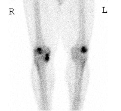 https://cdn.ncbi.nlm.nih.gov/pmc/blobs/7a6b/3445133/b9425ca78926/10.1177_1941738110397875-fig16.jpg