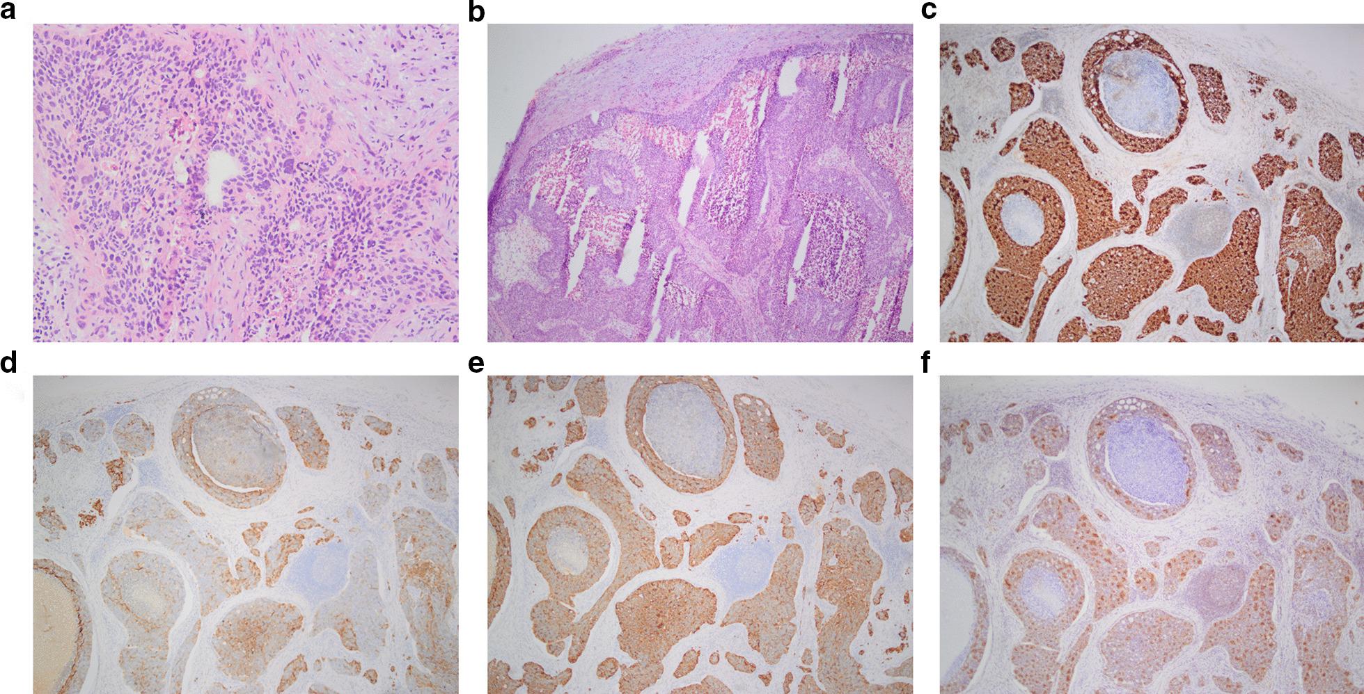 https://cdn.ncbi.nlm.nih.gov/pmc/blobs/7a6c/7874450/579fd5be0c77/12876_2021_1628_Fig2_HTML.jpg