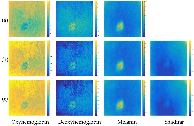 https://cdn.ncbi.nlm.nih.gov/pmc/blobs/7a72/11506256/dfc0b6a37b82/diagnostics-14-02288-g007.jpg