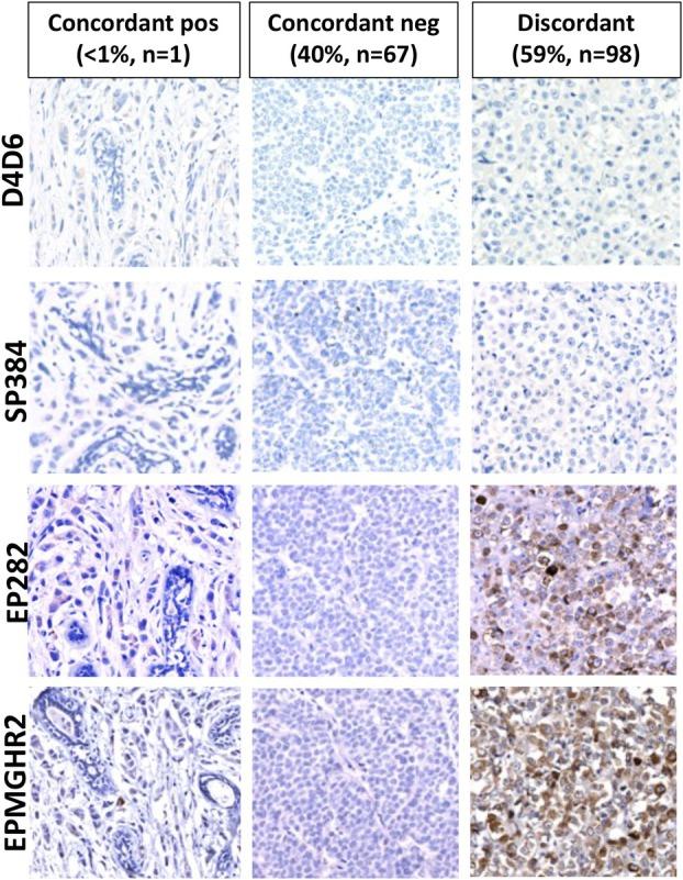https://cdn.ncbi.nlm.nih.gov/pmc/blobs/7a74/12232189/0da2d941b685/HIS-87-223-g005.jpg