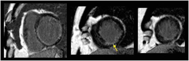 https://cdn.ncbi.nlm.nih.gov/pmc/blobs/7a7b/8874813/e2a2ead84636/ytac049f3.jpg