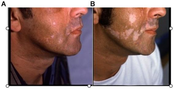 https://cdn.ncbi.nlm.nih.gov/pmc/blobs/7a80/11445008/5a478062ccfd/fmed-11-1424887-g006.jpg