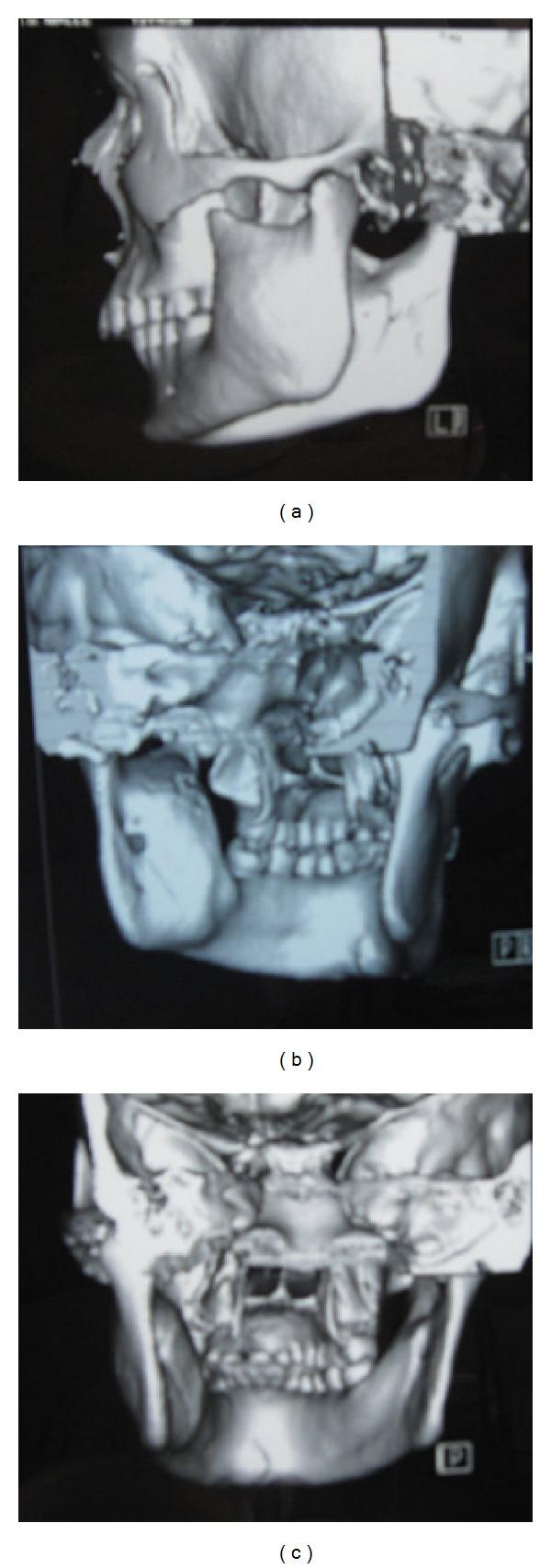 https://cdn.ncbi.nlm.nih.gov/pmc/blobs/7a80/4150428/11095a0aacfd/CRID2014-146989.005.jpg