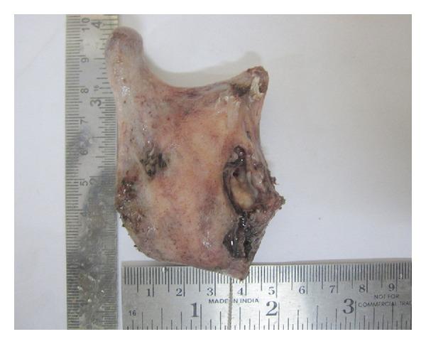 https://cdn.ncbi.nlm.nih.gov/pmc/blobs/7a80/4150428/1d3acfff12c5/CRID2014-146989.008.jpg