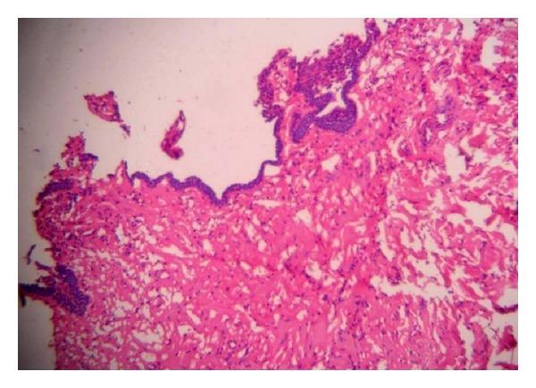 https://cdn.ncbi.nlm.nih.gov/pmc/blobs/7a80/4150428/26ca55af4e5e/CRID2014-146989.006.jpg