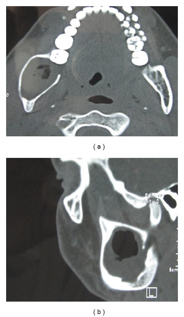 https://cdn.ncbi.nlm.nih.gov/pmc/blobs/7a80/4150428/8c2b7d7a6593/CRID2014-146989.004.jpg