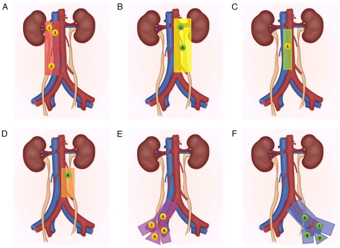 https://cdn.ncbi.nlm.nih.gov/pmc/blobs/7a83/12365877/cb9e65e13483/or-54-05-08970-g01.jpg