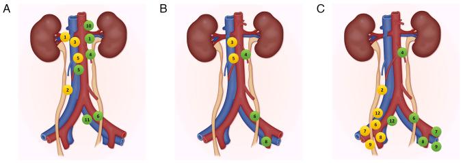 https://cdn.ncbi.nlm.nih.gov/pmc/blobs/7a83/12365877/d8a87a41789b/or-54-05-08970-g00.jpg