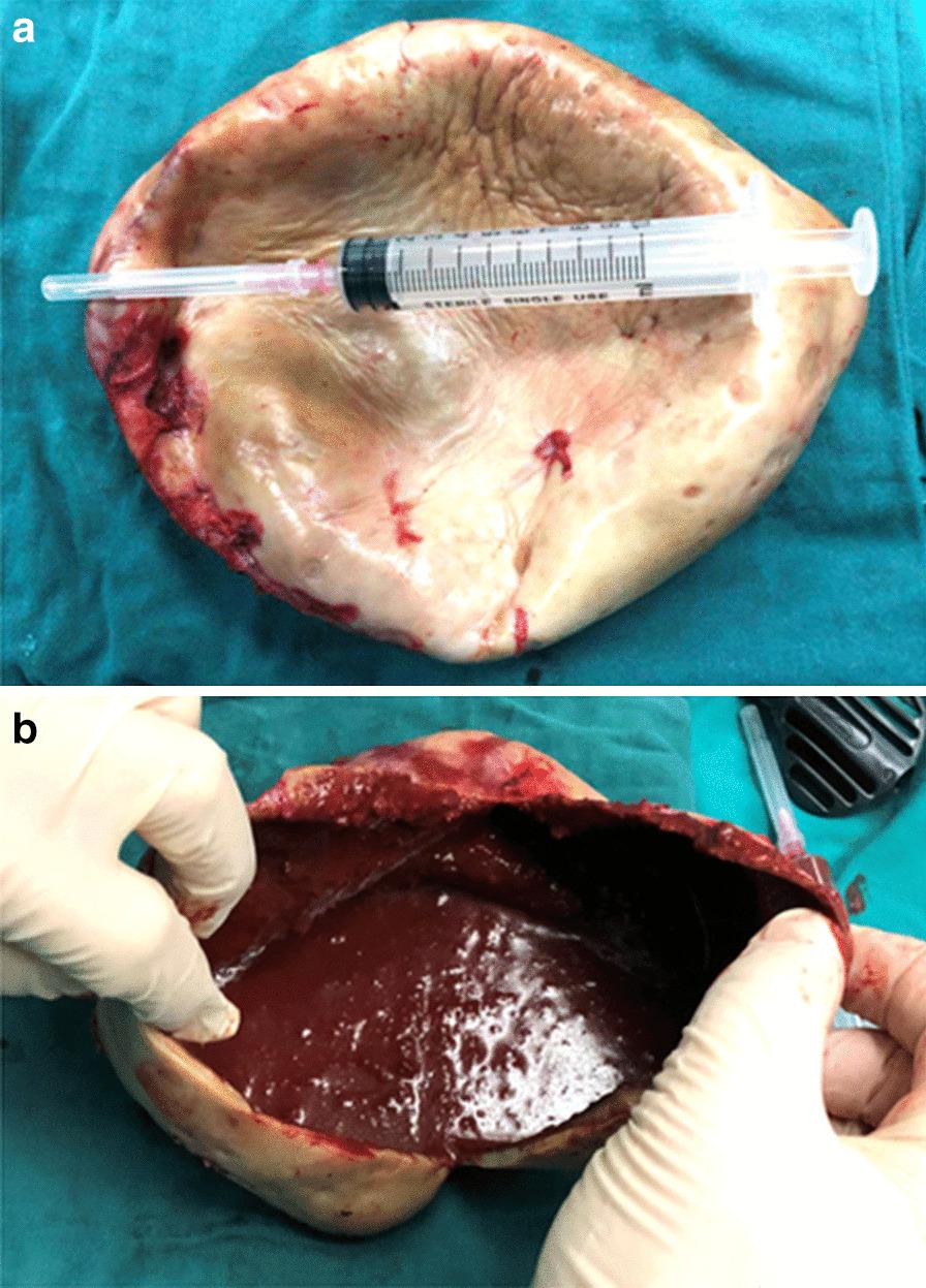 https://cdn.ncbi.nlm.nih.gov/pmc/blobs/7a84/7981930/7adc621e6de9/12893_2021_1161_Fig4_HTML.jpg