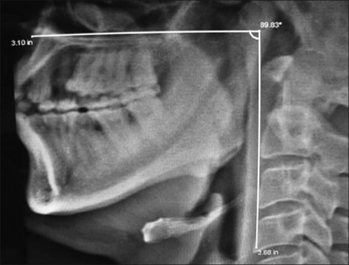 https://cdn.ncbi.nlm.nih.gov/pmc/blobs/7a86/2980661/71cf27799de7/SJA-4-158-g002.jpg