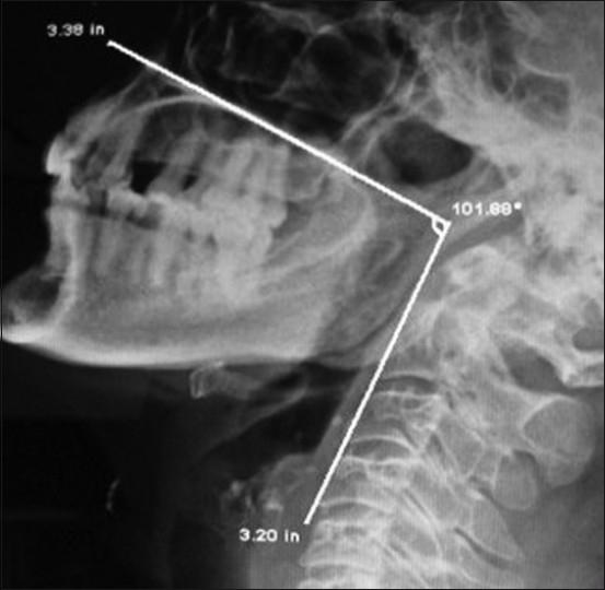 https://cdn.ncbi.nlm.nih.gov/pmc/blobs/7a86/2980661/f72081fdab23/SJA-4-158-g001.jpg