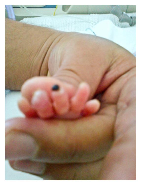 https://cdn.ncbi.nlm.nih.gov/pmc/blobs/7a89/3819912/2197d3b94ae1/CRIM.PEDIATRICS2013-608516.004.jpg