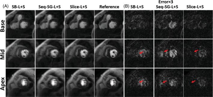 https://cdn.ncbi.nlm.nih.gov/pmc/blobs/7a89/9325064/6cffe41540e1/MRM-88-1140-g003.jpg