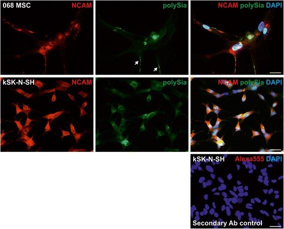 https://cdn.ncbi.nlm.nih.gov/pmc/blobs/7a91/4986182/72cc2a2f070b/13287_2016_373_Fig7_HTML.jpg