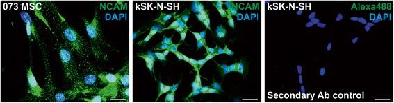 https://cdn.ncbi.nlm.nih.gov/pmc/blobs/7a91/4986182/b448136e541e/13287_2016_373_Fig6_HTML.jpg