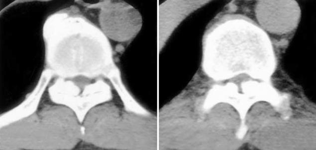 https://cdn.ncbi.nlm.nih.gov/pmc/blobs/7a93/2816904/a243b0874b1a/jkms-19-624-g001.jpg