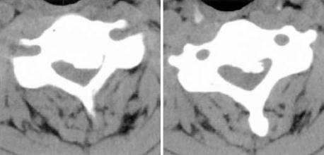 https://cdn.ncbi.nlm.nih.gov/pmc/blobs/7a93/2816904/bf87d574e778/jkms-19-624-g002.jpg