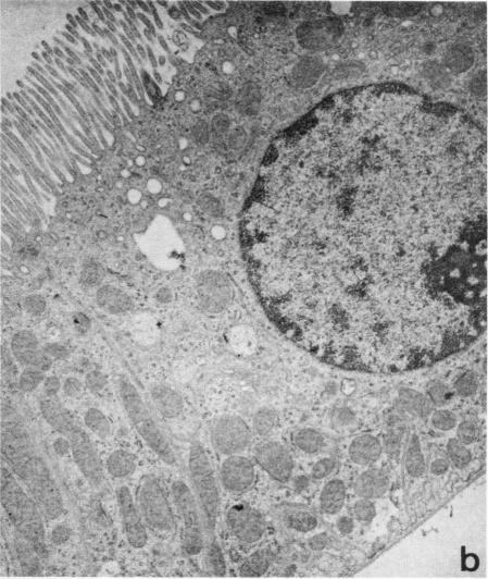 https://cdn.ncbi.nlm.nih.gov/pmc/blobs/7a94/372654/86d58f553568/jcinvest00665-0213-b.jpg