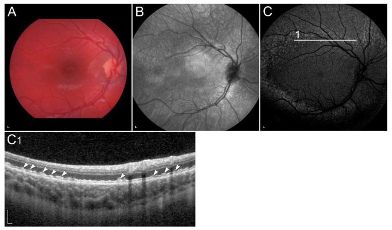 https://cdn.ncbi.nlm.nih.gov/pmc/blobs/7a9b/8835581/6f0dc7ec2211/ijms-23-01014-g005.jpg
