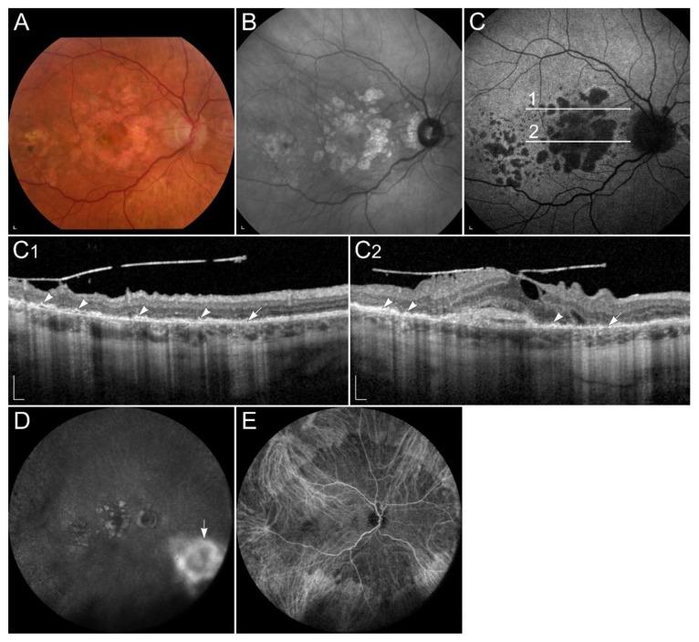 https://cdn.ncbi.nlm.nih.gov/pmc/blobs/7a9b/8835581/c4033e70650a/ijms-23-01014-g007.jpg