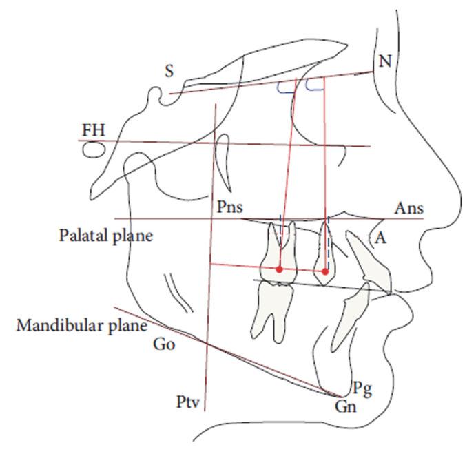 https://cdn.ncbi.nlm.nih.gov/pmc/blobs/7a9b/9600778/f4c63a955f4a/dentistry-10-00179-g005.jpg