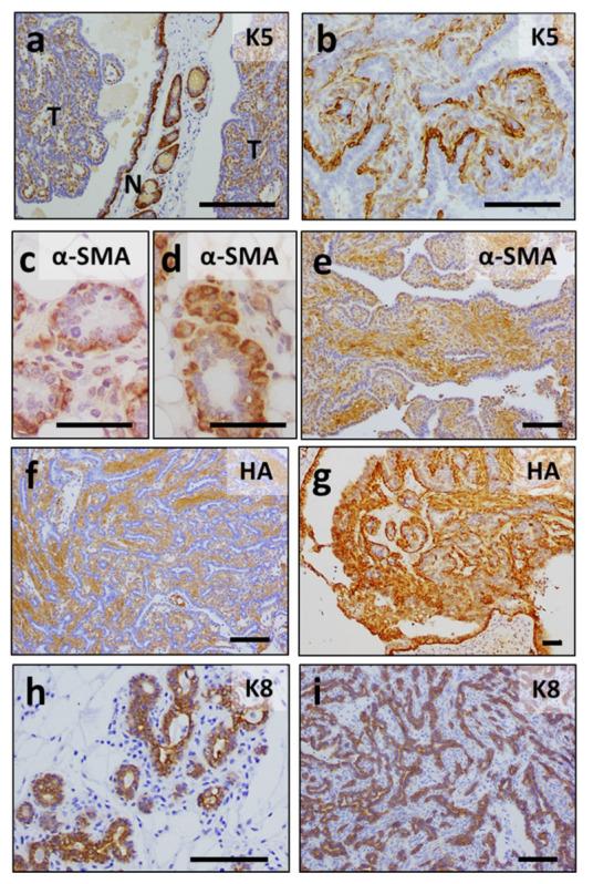 https://cdn.ncbi.nlm.nih.gov/pmc/blobs/7aa9/8582886/566d698c269e/cancers-13-05588-g008.jpg